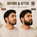 ibeard Natural Beard Growth Oil (50ml)