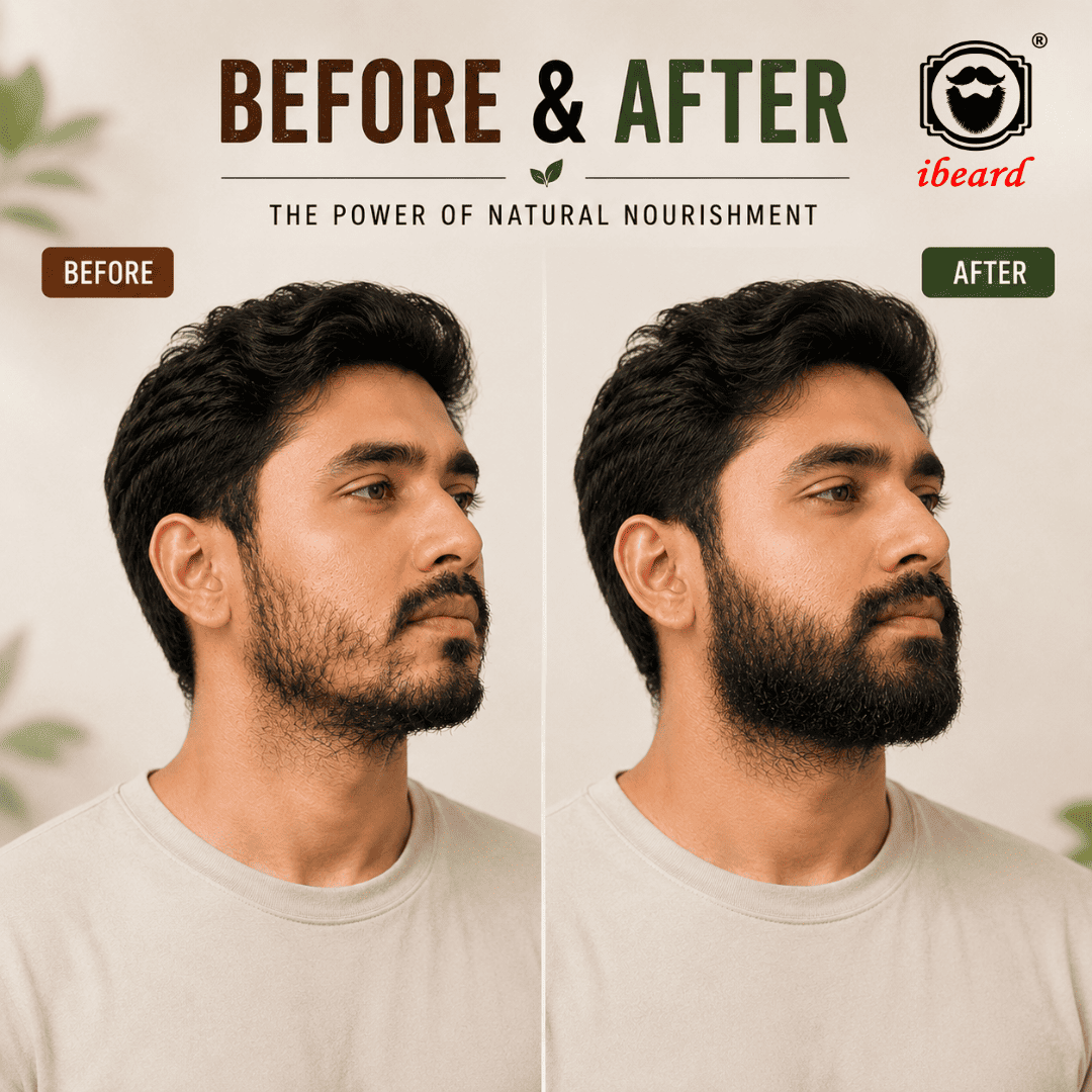 ibeard Natural Beard Growth Oil (50ml)